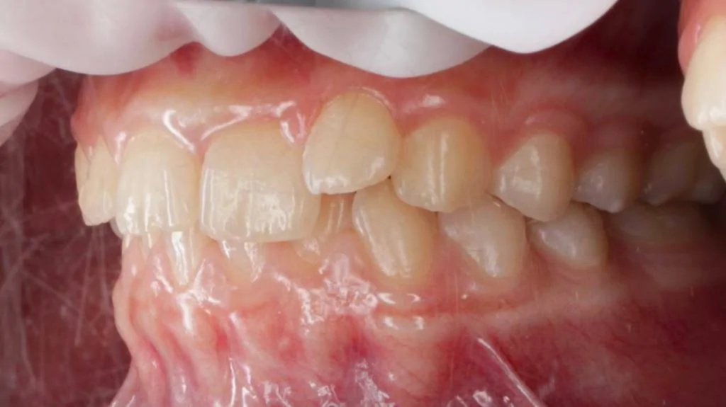 Портфолио - после 2